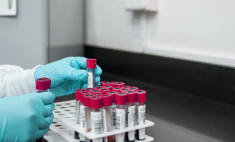 ما هو اختبار SMA والهدف منه