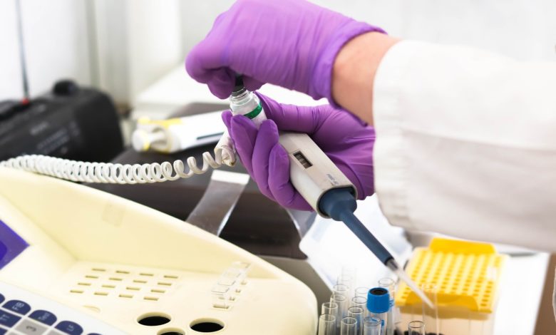 معلومات عامة عن اختبار CEA؟