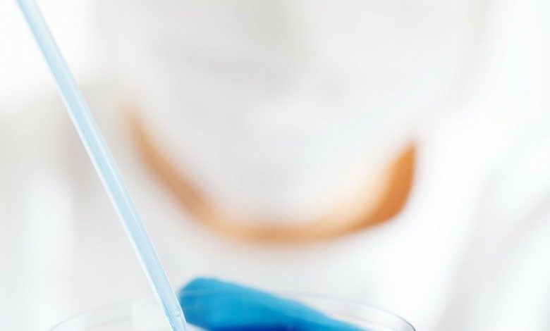 معلومات عامة عن اختبار Oxidase؟