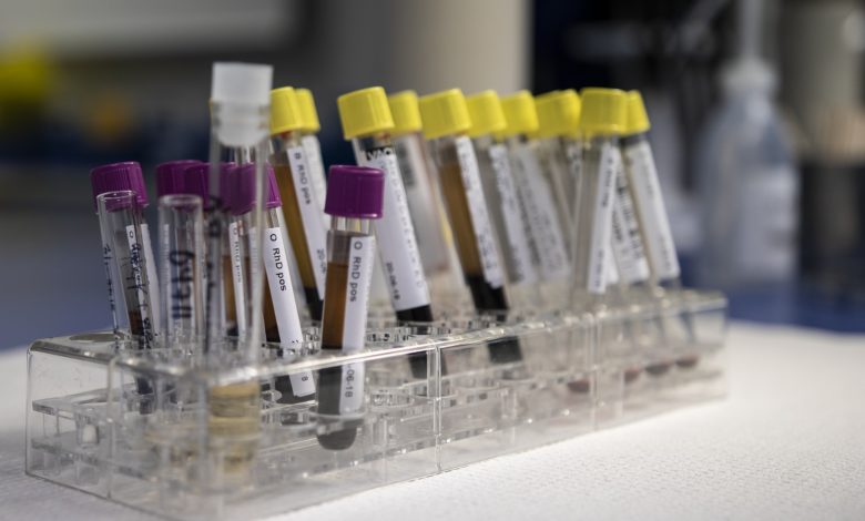 ما هو الفرق بين البلازما والسيرم